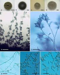 Attēlu rezultāti vaicājumam “Diderma subviridifuscum var. macrospora* macro”