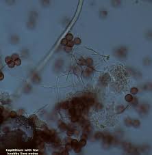 Attēlu rezultāti vaicājumam “Stemonitopsis hyperopta var. landewaldii spores”