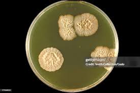 Attēlu rezultāti vaicājumam “Schistidium robustum sporophyte”