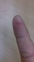 File:Finger cut.jpg - Wikipedia