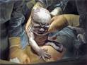 Damien Hirst's Caesarean Birth Paintings - Daddy Types
