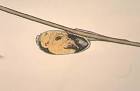 Head Lice Treatment - Minnesota Dept. of Health