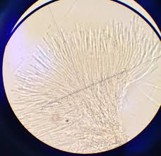 Attēlu rezultāti vaicājumam “Orbilia sp.”