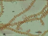 Attēlu rezultāti vaicājumam “Arcyria affinis”