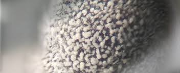 Attēlu rezultāti vaicājumam “Physarum luteolum spores”