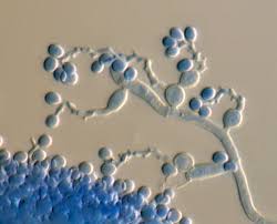 Attēlu rezultāti vaicājumam “Badhamia affinis var. microspora”