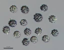 Attēlu rezultāti vaicājumam “Cribraria rubiginosa spores”