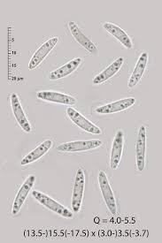 Attēlu rezultāti vaicājumam “Heyderia pusilla”