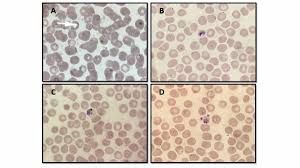 Attēlu rezultāti vaicājumam “Diderma cingulatum plasmodium”