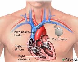 மாரடைப்பின் அறிகுறிகள் - Signs of Heart attack - வீடியோ இணைப்பு Images?q=tbn:ANd9GcT2vPahpHKwt0i4MvMbsgpz0OaFQEIXr-C2eQRtPqoX8FeGZ6j9zA