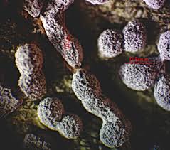 Attēlu rezultāti vaicājumam “Lycogala ustulatum sessile”