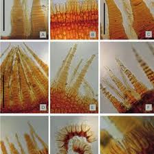 Attēlu rezultāti vaicājumam “Pohlia wahlenbergii sporophyte”
