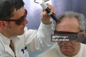 Image result for schamhaar