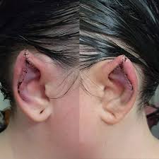 Image result for ear mod
