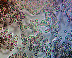 Attēlu rezultāti vaicājumam “Lycogala botrydium macro”