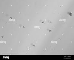 Attēlu rezultāti vaicājumam “Didymium spongiosum spores”