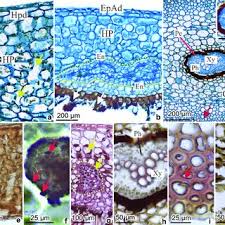 Attēlu rezultāti vaicājumam “Sacchiphantes abietis exuvia”