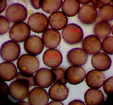 Attēlu rezultāti vaicājumam “Badhamia lilacina var. megaspora”