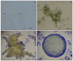 Attēlu rezultāti vaicājumam “Enteridium liceoides spores”