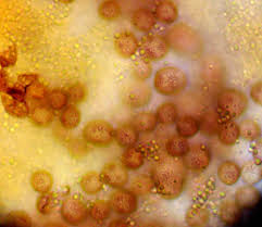 Attēlu rezultāti vaicājumam “Lycogala ustulatum young”