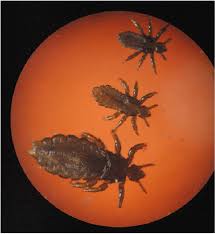 Attēlu rezultāti vaicājumam “Pediculus humanus capitis”