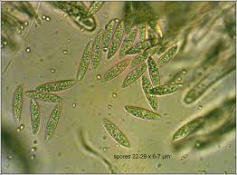 Attēlu rezultāti vaicājumam “Ascocoryne cylichnium”