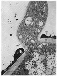 Attēlu rezultāti vaicājumam “Enteridium corticatum spores”