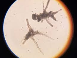 Attēlu rezultāti vaicājumam “Physarum obscurum plasmodium”