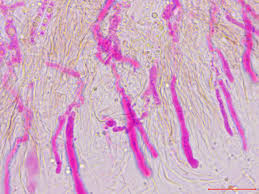 Attēlu rezultāti vaicājumam “Cylindrobasidium evolvens”
