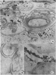 Attēlu rezultāti vaicājumam “Diderma testaceum young”
