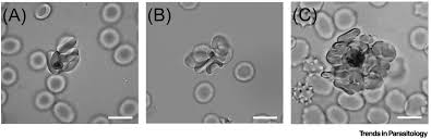 Attēlu rezultāti vaicājumam “Reticularia lobata plasmodium”
