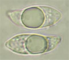 Attēlu rezultāti vaicājumam “Tremellodendropsis tuberosa”