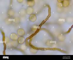 Attēlu rezultāti vaicājumam “Gulielmina vermicularis macro”