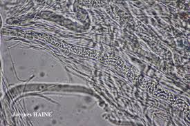 Attēlu rezultāti vaicājumam “Stictis”