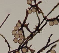 Attēlu rezultāti vaicājumam “Enerthenema papillatum spores”