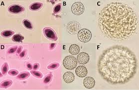 Attēlu rezultāti vaicājumam “Badhamiopsis macrospora spores”