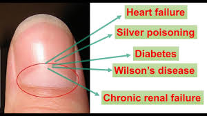 Image result for lunula nail