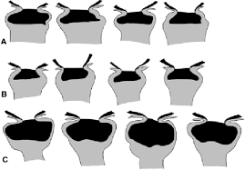 Attēlu rezultāti vaicājumam “Sphagnum centrale sporophyte”