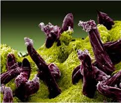 Attēlu rezultāti vaicājumam “Lignydium muscorum plasmodium”