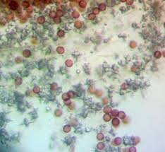 Attēlu rezultāti vaicājumam “Didymium xanthopus macro”