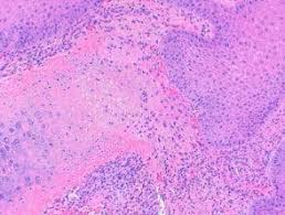 Attēlu rezultāti vaicājumam “Diderma chondrioderma macro”