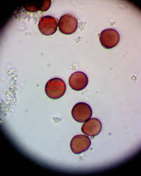 Attēlu rezultāti vaicājumam “Physarum oblatum spores”