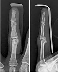 Image result for 뺾