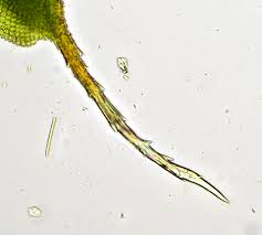 Attēlu rezultāti vaicājumam “Heterotrichia oerstedii (syn. Arcyria oerstedii) sessile”