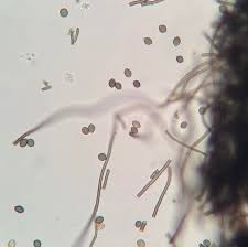 Attēlu rezultāti vaicājumam “Comatricha elegans var. microspora spores”