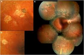 Attēlu rezultāti vaicājumam “Reticularia sp.”