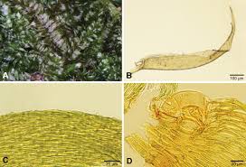Attēlu rezultāti vaicājumam “Octospora humosa”