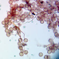 Attēlu rezultāti vaicājumam “Diderma chondrioderma sessile”