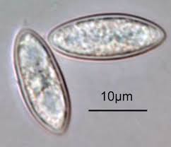Attēlu rezultāti vaicājumam “Lachnellula willkommii”