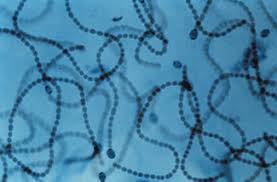 Attēlu rezultāti vaicājumam “Nostoc commune cells”